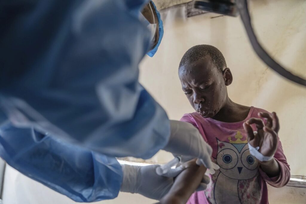 Los expertos afirman que los brotes de mpox en África son resultado de la negligencia y la incapacidad del mundo para detener las epidemias.