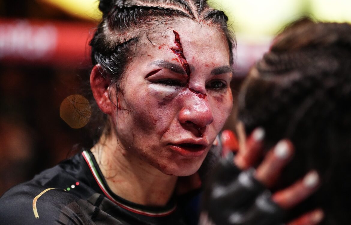 Video | Irene Aldana sufre brutal corte en el rostro en su derrota ante a Norma Dumont