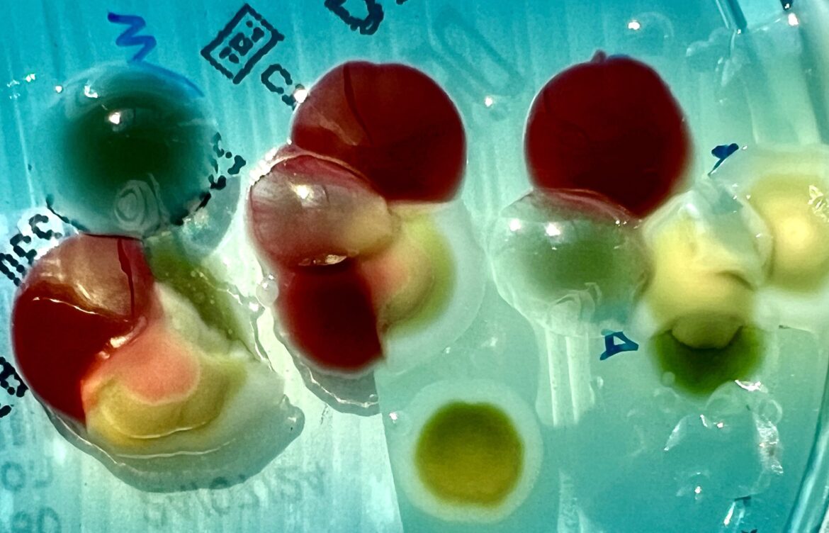 Secretaría de Salud emite alerta epidemiológica por la bacteria Klebsiella oxytoca