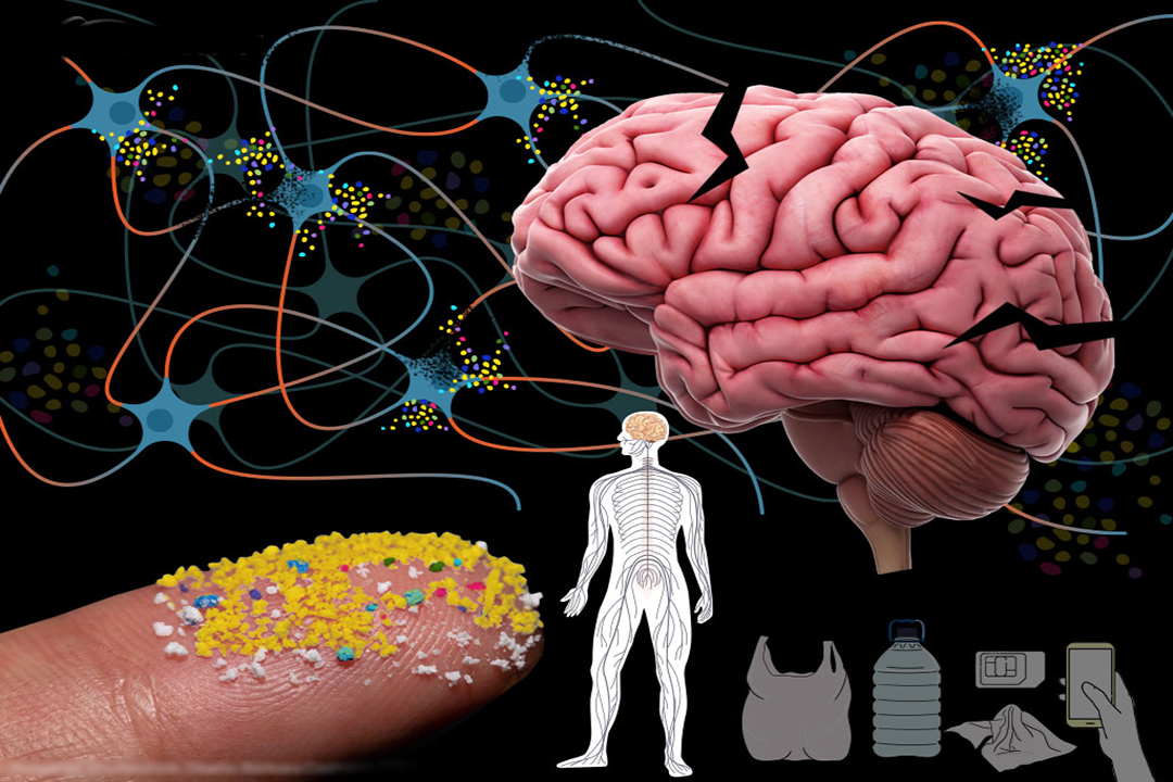 ¿Una cuchara de plástico en tu cerebro?