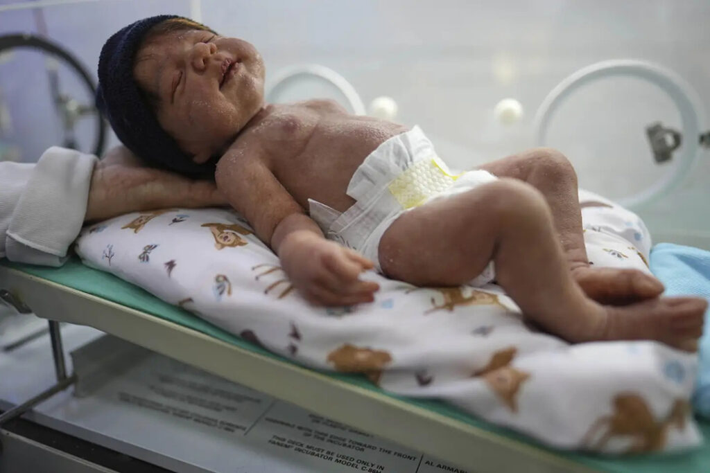 Reborn dolls, or hyper-realistic dolls, have carved out a unique niche in both art and therapeutic circles in Brazil pic.twitter.com/wGNqF1Hxzr— Reuters (@Reuters) May 28, 2025