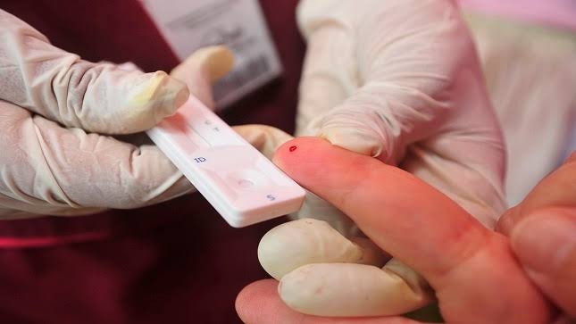 FDA aprueba tratamiento bianual revolucionario contra VIH