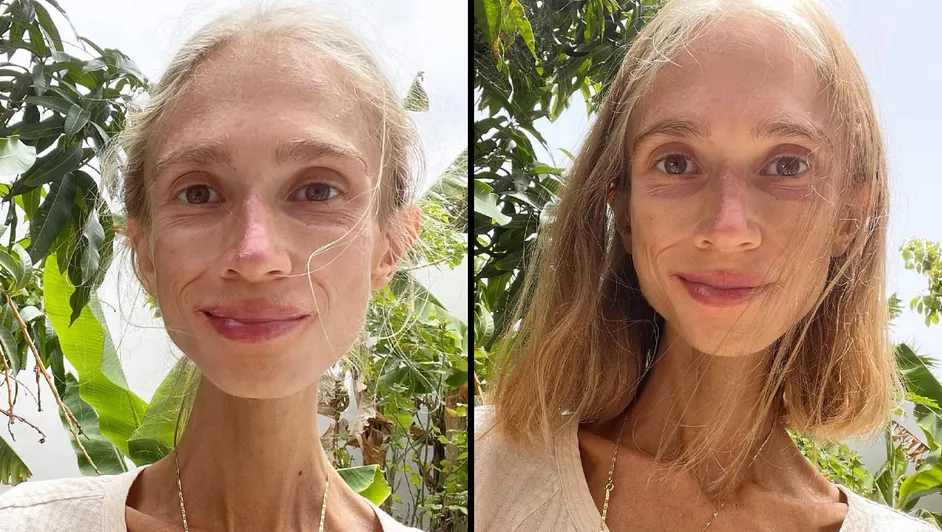 Muere joven de 27 años en Bali tras seguir dieta frutariana extrema